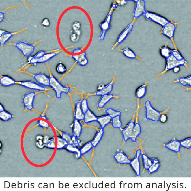 Evaluation of Neurite Outgrowth4